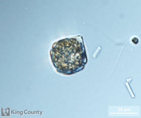 Photo of Scrippsiella trochoidea